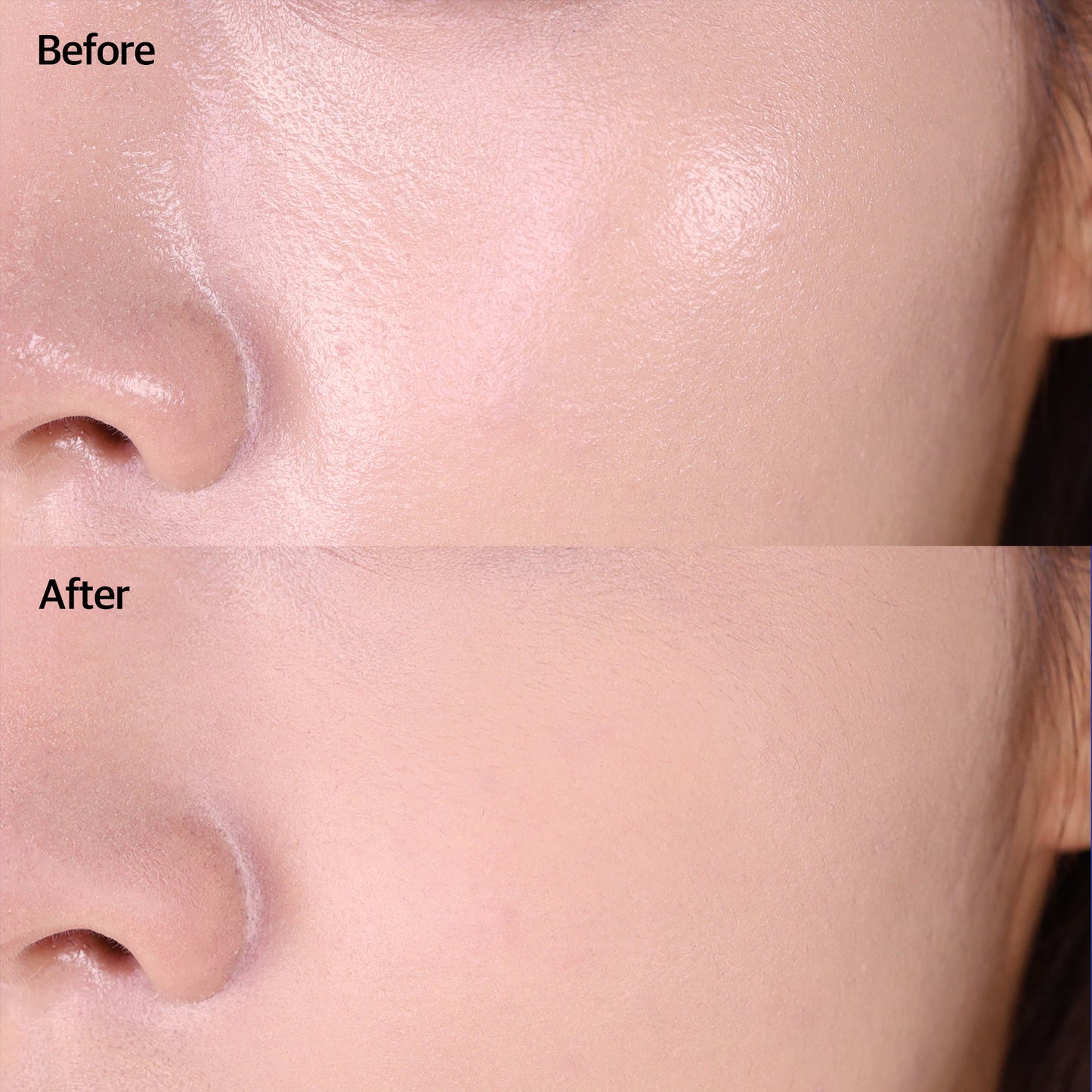 SEBUM CONTROL PACT